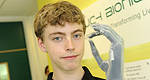 F1: Touch Bionics and Mercedes F1 work together to help Matthew James